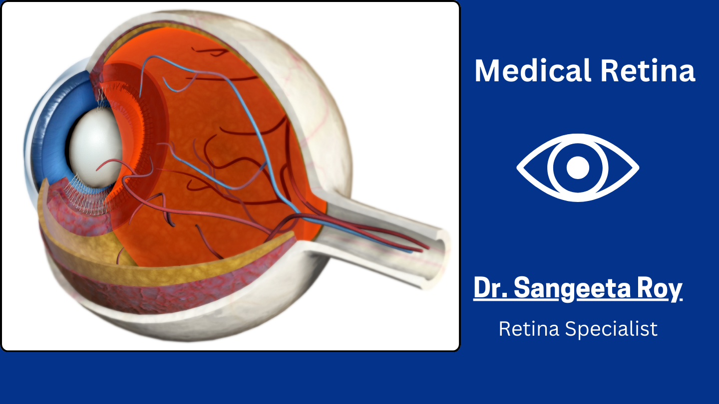 Medical Retina Treatment in Kolkata